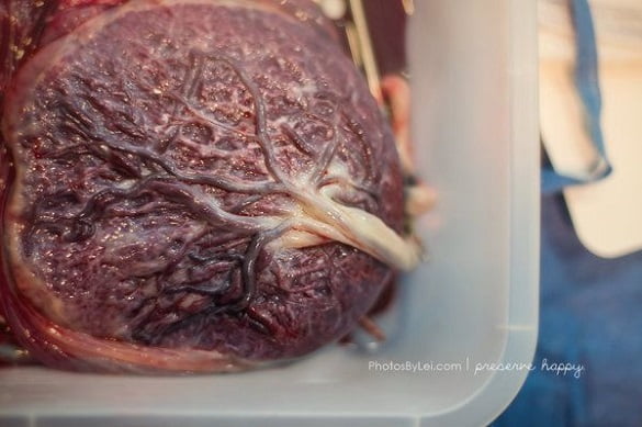 placenta