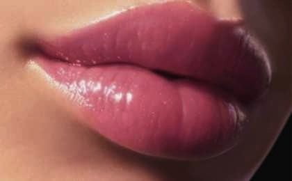 buze hialuronic