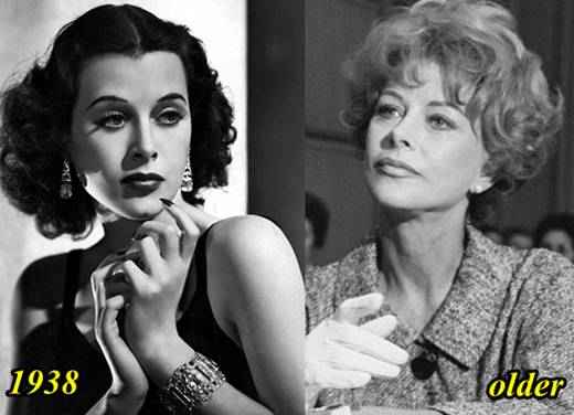 Hedy-Lamarr-Plastic-Surgery