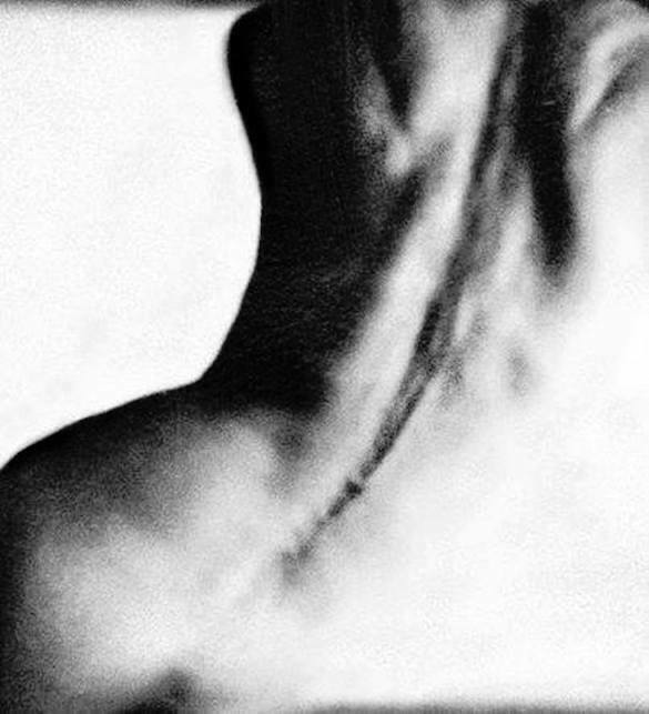 Ray K. Metzker