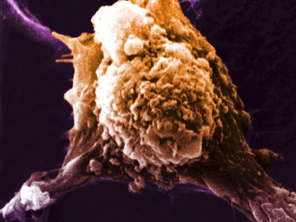 cancer-cell