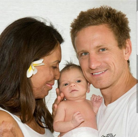 turia pitt