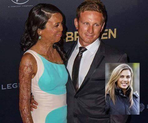 turia pitt michael hoskin