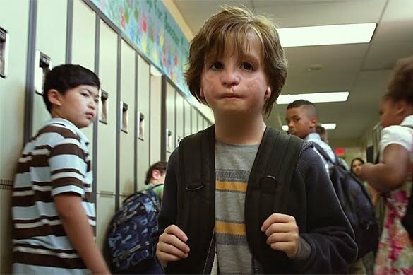 Wonder 2
