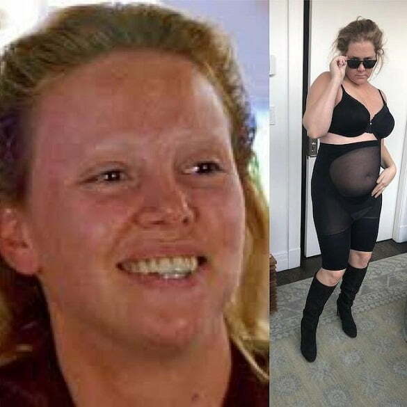 Amy Schumer